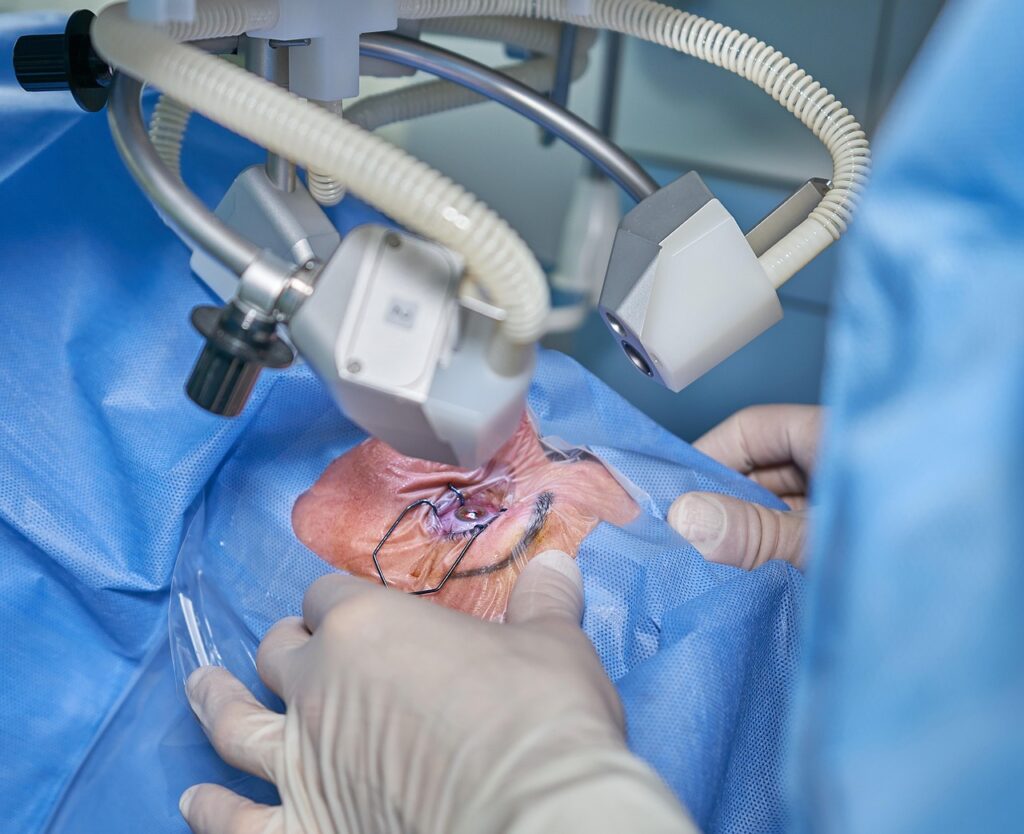 Doctor performing eye laser surgery using precision robotic tools.